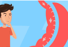 Answering 7 Common Questions about Gastric Sleeve Surgery Answering 7 Common Questions about Gastric Sleeve Surgery