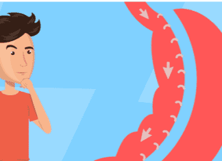 Answering 7 Common Questions about Gastric Sleeve Surgery Answering 7 Common Questions about Gastric Sleeve Surgery