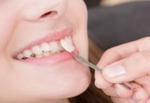 Affordable Dental Implants: 4 Things You Should Know Teeth