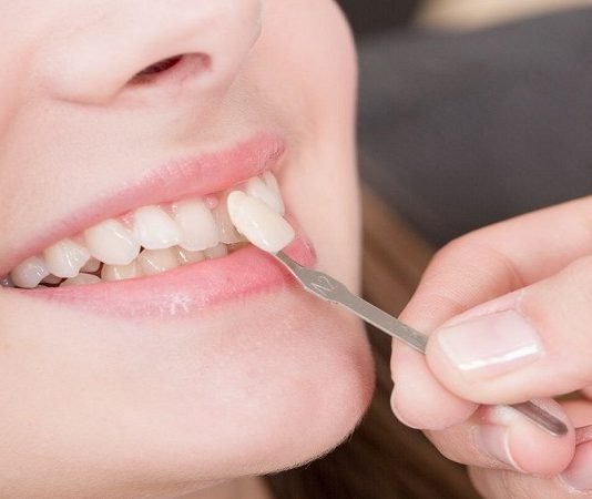 5 Common Types of Dental Surgeries Teeth