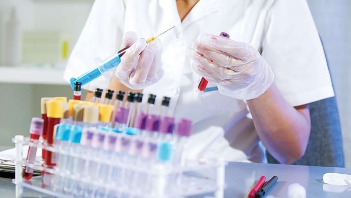 Things To Consider Before A Blood Test In Pathology Labs