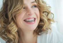 Braces for Adults Price: What You Need to Know Braces