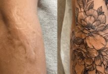 Tattoo Over Scars Before and After – Everything You Need to Know Tattoo Over Scars Before and After - You Need to Know