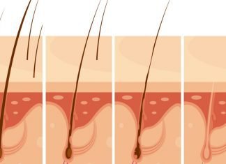 The Journey to Beautiful Hair: Unlocking Youthfulness with Veraclinic Preventing Hair Fall through Hair Transplant: What Does 1 Graft of Hair Cost?