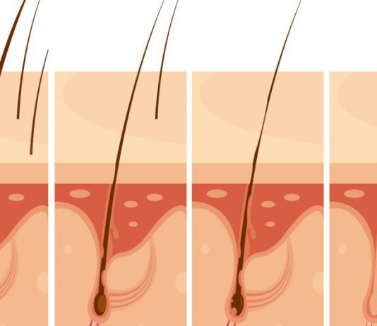 The Journey to Beautiful Hair: Unlocking Youthfulness with Veraclinic Preventing Hair Fall through Hair Transplant: What Does 1 Graft of Hair Cost?