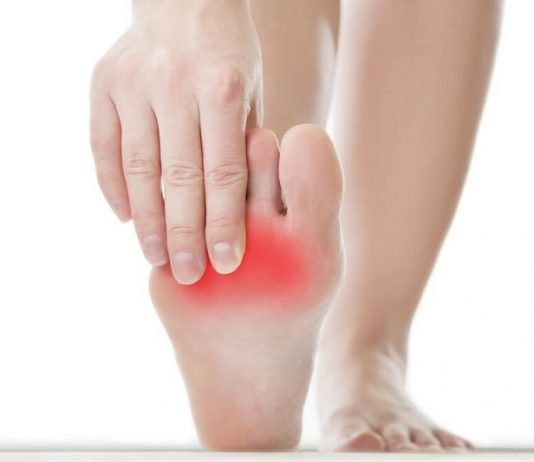 4 Natural Ways to Reduce Neuroma neuroma