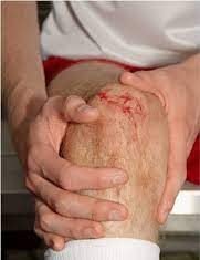 What To Do About an Unexpected Injury Injury