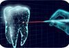 Laser Implant Dentistry