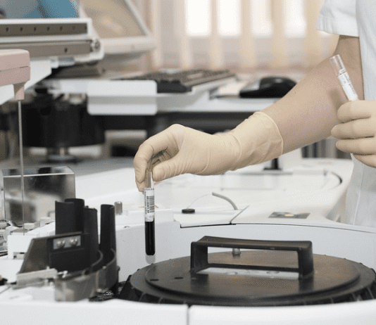 A Comprehensive Overview of HPLC Columns HPLC Columns