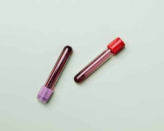 Protecting Your Rights if Facing a DUI Blood Draw Warrant blood draw