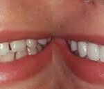 A Quick Look into Cosmetic Dentistry to Understand Who Needs This and Why! Cosmetic Dentistry