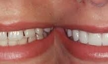 A Quick Look into Cosmetic Dentistry to Understand Who Needs This and Why! Cosmetic Dentistry