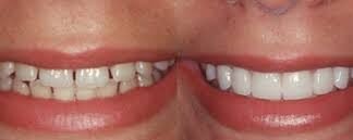 A Quick Look into Cosmetic Dentistry to Understand Who Needs This and Why! Cosmetic Dentistry