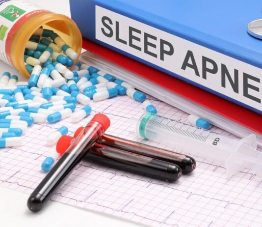 Improving Sleep Naturally – Strategies for Sleep Apnea Sleep Apnea