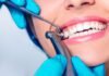 How to Maintain a Bright Smile and Fresh Breath: Key Oral Care Tips Oral Care